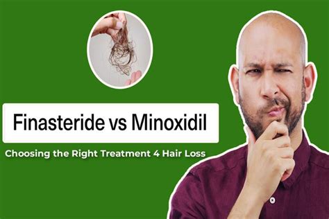 Minoxidil Vs Finasteride Choosing The Right Treatment 4 Hair Loss Dr Nagwani