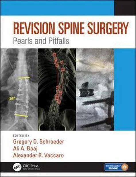 Revision Spine Surgery 9781498773829 Boeken Bol