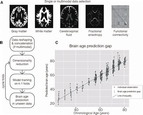 Overview Of The Brain Age Prediction Process A Example Of Input