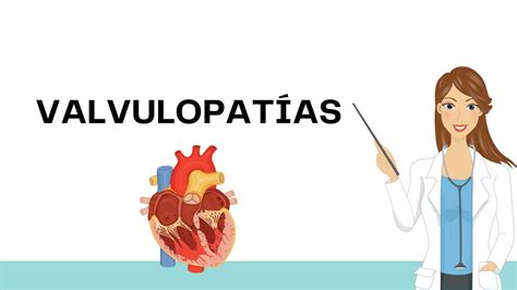 Valvulopat As Anatomia Udocz