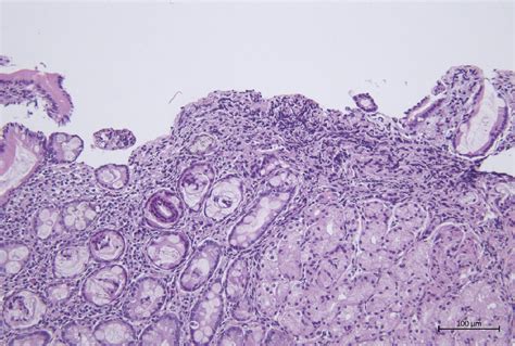 Figure From Retrospective Evaluation Of The Most Frequently Observed