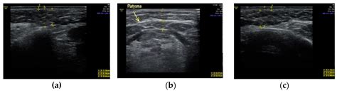 Applied Sciences Free Full Text Possibilities Of Ultrasound