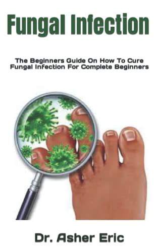 Fungal Infection The Beginners Guide On How To Cure Fungal Infection For Complete Beginners By