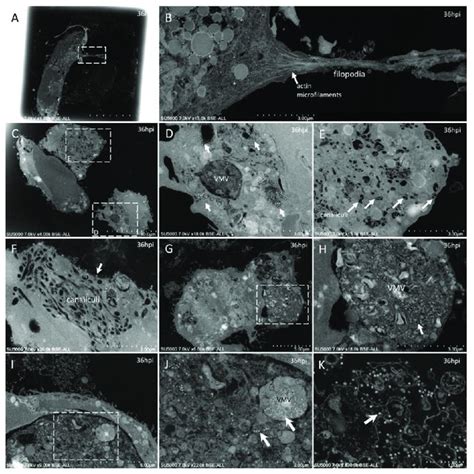 Ultra Thin Sections Of Sars Cov 2 Infected Vero E6 Cells 12 Hpi Download Scientific Diagram