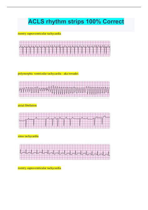 Acls Precourse Self Assessment Rhythm Identification Hotsell Jkuat Ac Ke