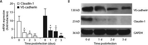 Human Umbilical Vein Endothelial Cells Huvecs Infected With Hantaan