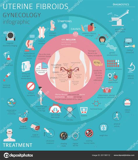 Uterine Fibroids Ginecological Medical Desease Women Infographic Vector