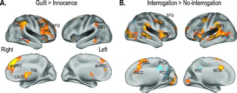 Statistical Parametric Maps For Main Effects A Brain Regions