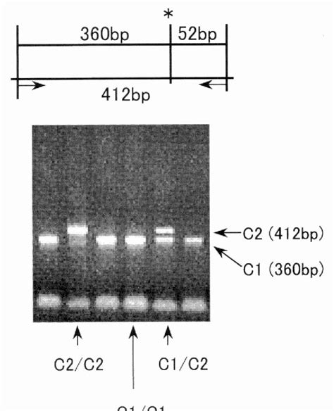 Figure 2 From The Association Of The Cytochrome P450 2E1 Genetic