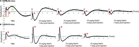 Effects Of 15 Mg Kg Of NaIO 3 On The Waveforms Of Scotopic