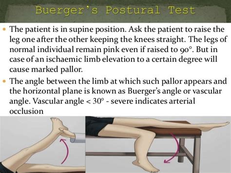 Test for peripheral arterial and venous circulation