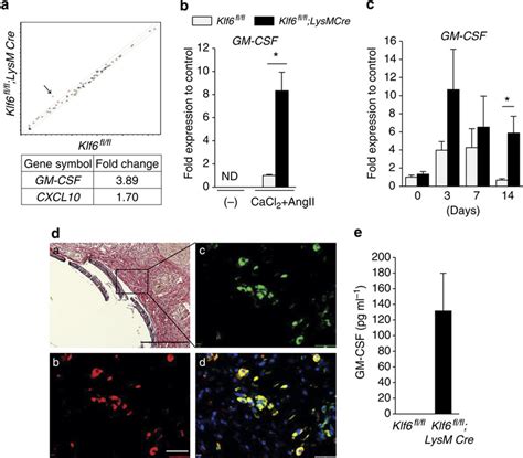 GM CSF Is A Direct Target Of KLF6 In Macrophages A RT2 Profiler PCR