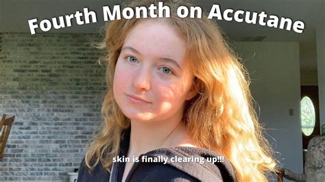 Accutane Journey Month 4 YouTube