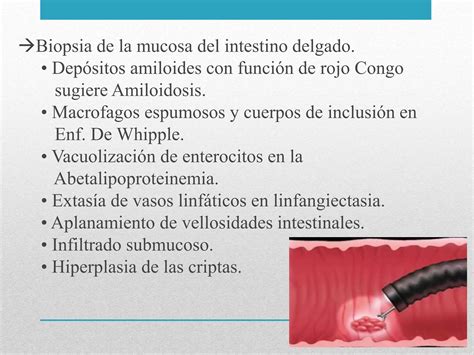 Said malabsorción Síndrome De Absorción intestinal Deficiente PPT