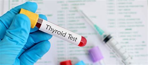 Thyroid Test What Does It Look Like How Much Does It Cost Or Should