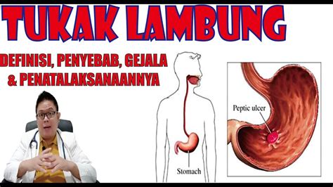 TUKAK LAMBUNG DEFINISI PENYEBAB GEJALA DAN