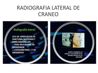 RADIOGRAFIAS Intraorales Y Extraoral Odontologia PPT Descarga Gratuita