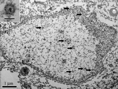 Electron Micrograph Of The Naked Particles Of Herpesvirus Arrow Heads