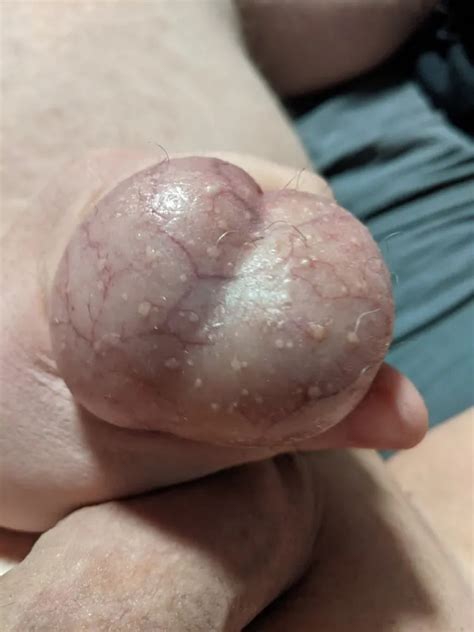 Ball Pictures My Balls Hurting Nude Pics XHamster