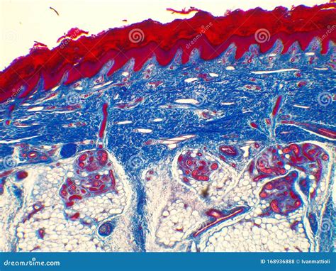 Human Epidermis Microscope