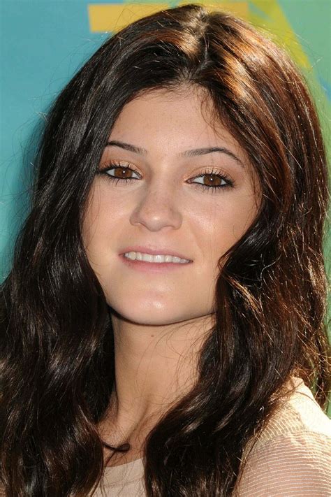 kylie jenner before plastic surgery 8