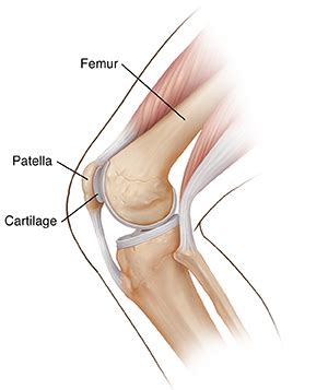 Knee Preservation With Cartilage Repair Meniscus Repair