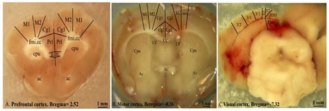 Coronal section of the A: prefrontal (Bregma 5.16 to 1.56 mm), B: motor ...