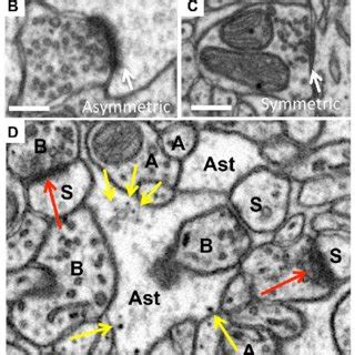 Identification Of Synapses And Glycogen Granules Examples Of Synapses