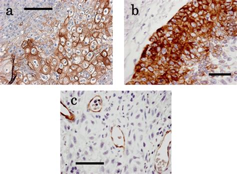 Demonstrative Immunohistochemical Images Of A Hla G B Mfg E And