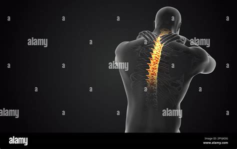 Articulación Del Cuello Y El Concepto Médico Del Dolor De La Columna Vertebral Fotografía De