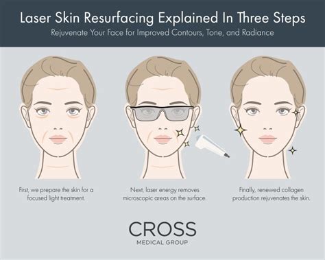 Laser Skin Resurfacing Philadelphia Pa Cross Medical Group