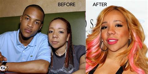 Tiny Harris Before And After Plastic Surgery En El Ajo En El Ajo