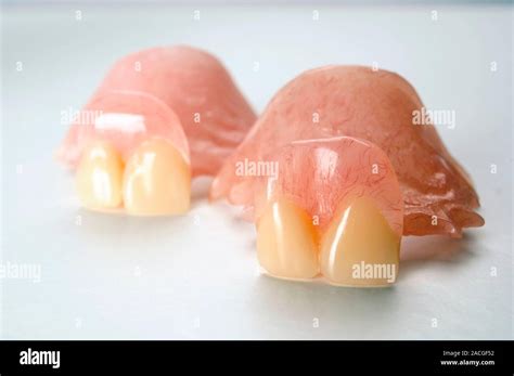 Dentaduras de plástico Estas son las dentaduras diseñado para