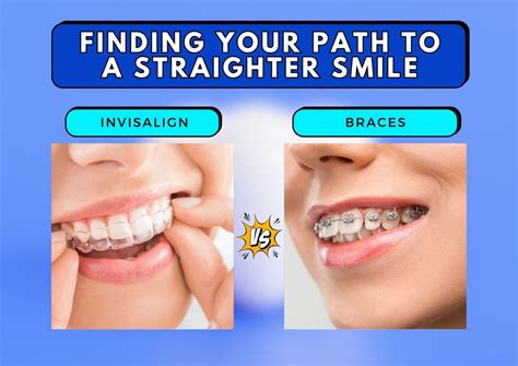 Invisalign Vs Braces Finding Your Path To A Straighter Smile Thind