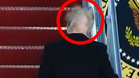 Donald Trump S Hair Secrets Revealed From Drugs And Surgery To