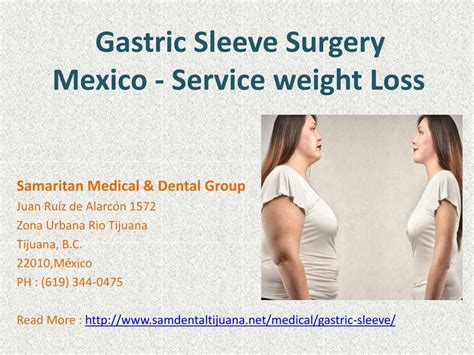 Ppt Gastric Sleeve Tijuana Mexico Surgery In Mexico Powerpoint