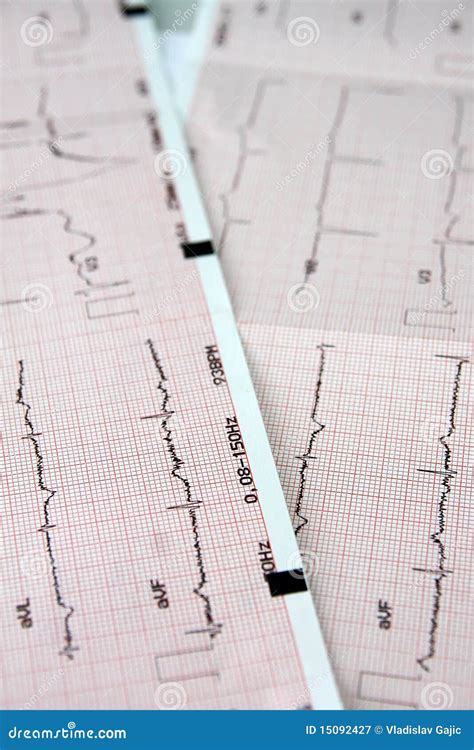 Ekg Stock Image Image Of Examining Imaging Treatment 15092427