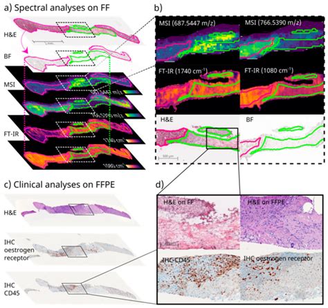 Cancers Free Full Text Spatial Omics Imaging Of Fresh Frozen Tissue And Routine Ffpe