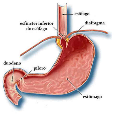 Cirurgia do Refluxo Gastroesofágico Dr Guines Alvarez