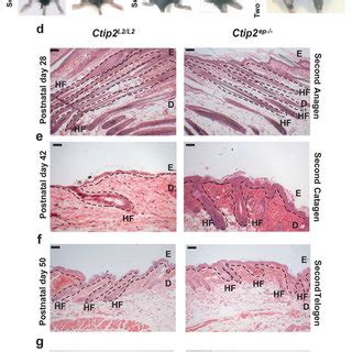 Conditional Ablation Of Ctip In Adult Epidermis Leads To Altered