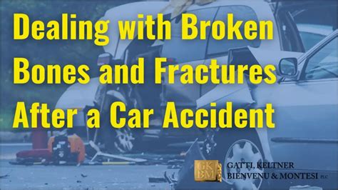 What to Do With Broken Bones: Car Accident Injuries Explained