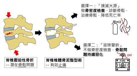 骨折正是「骨質疏鬆」的警訊！骨密度檢查的必要性 Heho健康