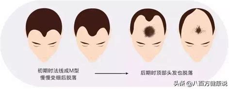 吳彥祖脫髮是怎麼回事？曾經的男神竟變成這樣 每日頭條