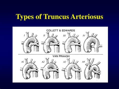 Ppt Truncus Arteriosus Powerpoint Presentation Free Download Id 597141