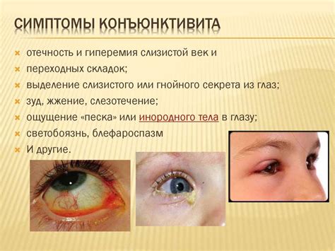 Инфекции глаз человека: какие заболевания к ним относятся, чем лечатся