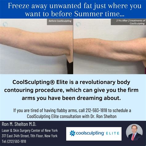 Get Rid Of Upper Arm Excess Fat With Coolsculpting Elite Before Summer