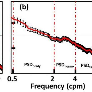 Power Spectral Density Psd Plots From Different Gestational Age