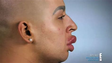 See Male Kim Kardashian Wannabe Before Surgery Revealing His Dramatic