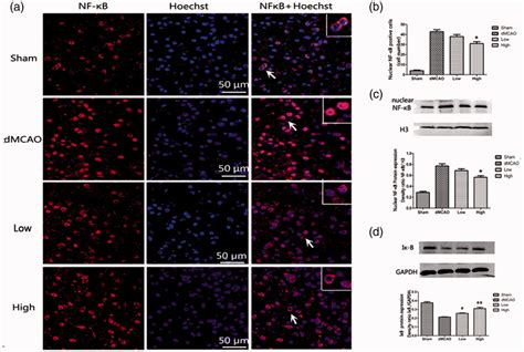 Artesunate inhibited the translocation of nuclear factor NF κB a