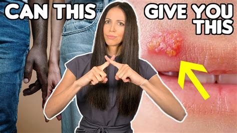 Can You Get Genital Herpes From Cold Sores Youtube